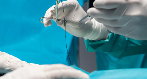 Implantes